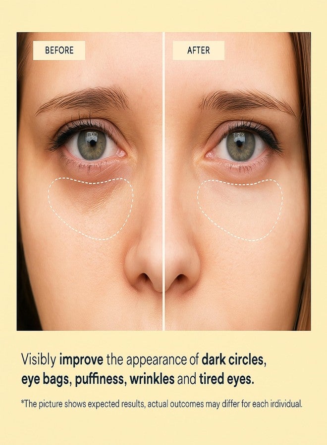 MAVENI 24K Gold Eye Mask-Under Eye Patches for Dark Circles-60 Pcs for Puffy Eyes,Anti-Aging,Bags & Wrinkles,Boost Lift & Firm the Look of the Eye Area,Hydrating, Anti-Wrinkle & Cooling - Image 2